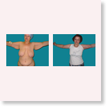 example2
