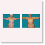 example2
